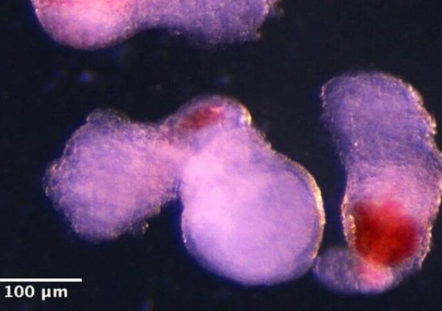 قبل از تعرض به انستیتو پاستور نمونه‌های سلولی خارج شده بودند