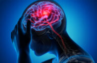 تحریک نخاع به بازیابی قدرت بازو پس از سکته مغزی کمک می کند